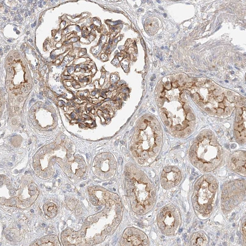 Immunohistochemical staining of human kidney shows moderate membranous positivity in cells in tubules and in glomeruli.