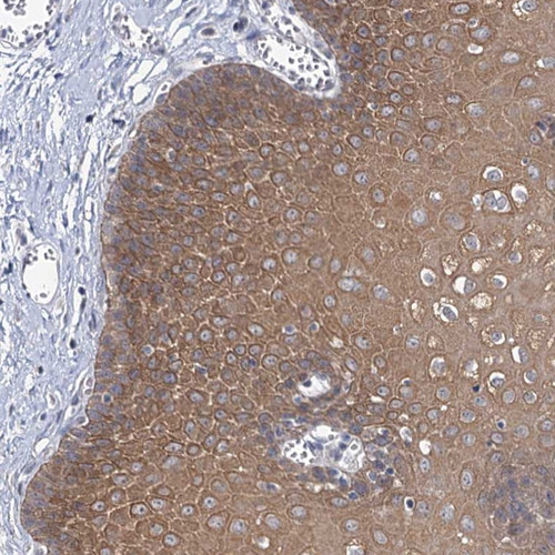 Immunohistochemical staining of human esophagus shows moderate cytoplasmic positivity in squamous epithelial cells.