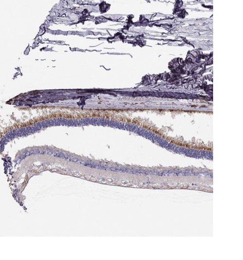 Immunohistochemical staining of human retina shows cytoplasmic positivity in rods and nerve fibers.