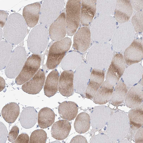 Immunohistochemical staining of human skeletal muscle shows moderate cytoplasmic positivity in myocytes.
