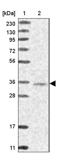 Lane 1: Marker [kDa] 230, 130, 95, 72, 56, 36, 28, 17, 11<br/>Lane 2: Human cell line RT-4