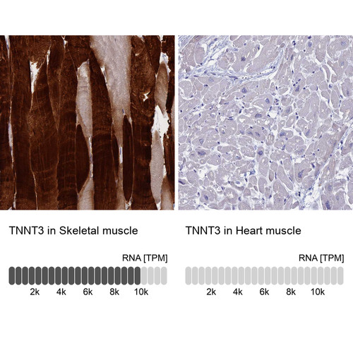 Immunohistochemistry analysis in human skeletal muscle and heart muscle tissues using HPA037810 antibody. Corresponding TNNT3 RNA-seq data are presented for the same tissues.