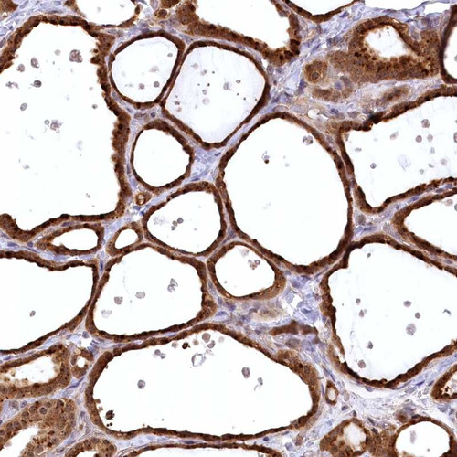 Immunohistochemical staining of human thyroid gland shows strong cytoplasmic and nuclear positivity in glandular cells.