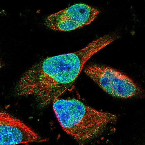 Immunofluorescent staining of human cell line U-251 MG shows localization to nucleoplasm, nuclear membrane & cytosol.