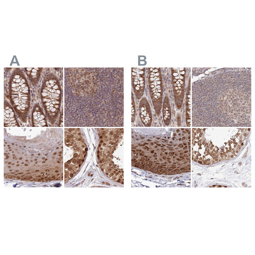 Immunohistochemical staining of human colon, lymph node, skin and testis using Anti-WAPL antibody HPA037875 (A) shows similar protein distribution across tissues to independent antibody HPA037874 (B).