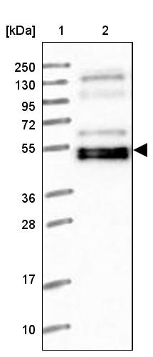 Lane 1: Marker [kDa] 250, 130, 95, 72, 55, 36, 28, 17, 10<br/>Lane 2: Human cell line RT-4