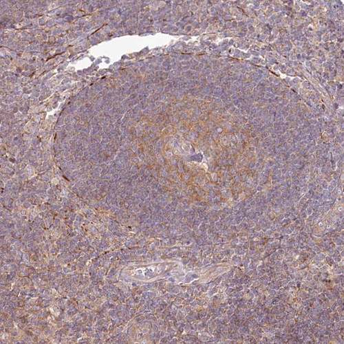 Immunohistochemical staining of human lymph node shows moderate cytoplasmic positivity in germinal center cells.