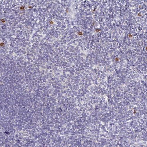 Immunohistochemical staining of human tonsil shows strong cytoplasmic positivity in subset of non-germinal center cells.