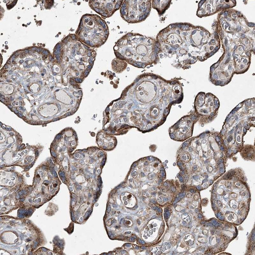 Immunohistochemical staining of human placenta shows cytoplasmic positivity in trophoblastic cells.