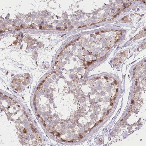 Immunohistochemical staining of human testis shows moderate cytoplasmic positivity in a subset of cells in seminiferous ducts.
