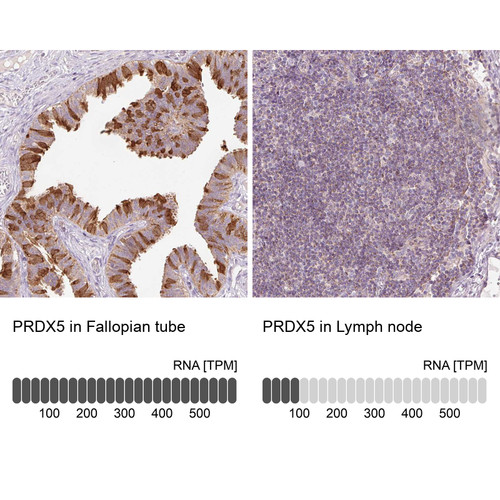 Immunohistochemistry analysis in human fallopian tube and liver tissues using Anti-PRDX5 antibody. Corresponding PRDX5 RNA-seq data are presented for the same tissues.