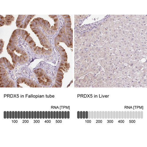 Immunohistochemistry analysis in human fallopian tube and liver tissues using Anti-PRDX5 antibody. Corresponding PRDX5 RNA-seq data are presented for the same tissues.