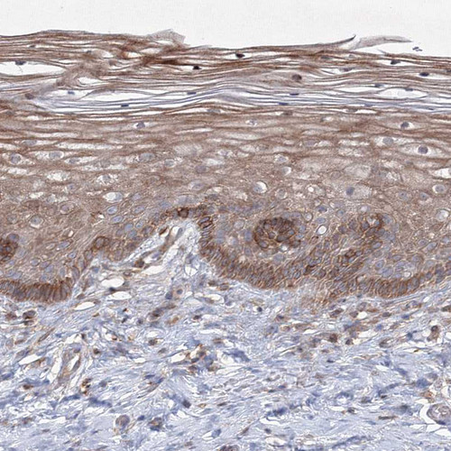 Immunohistochemical staining of human cervix, uterine shows moderate cytoplasmic positivity in squamous epithelial cells.