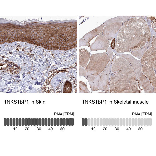 Immunohistochemistry analysis in human skin and skeletal muscle tissues using Anti-TNKS1BP1 antibody. Corresponding TNKS1BP1 RNA-seq data are presented for the same tissues.