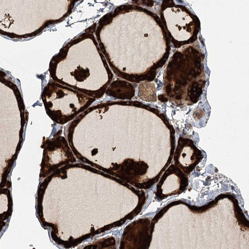 Immunohistochemical staining of human thyroid gland shows strong cytoplasmic positivity in glandular cells.