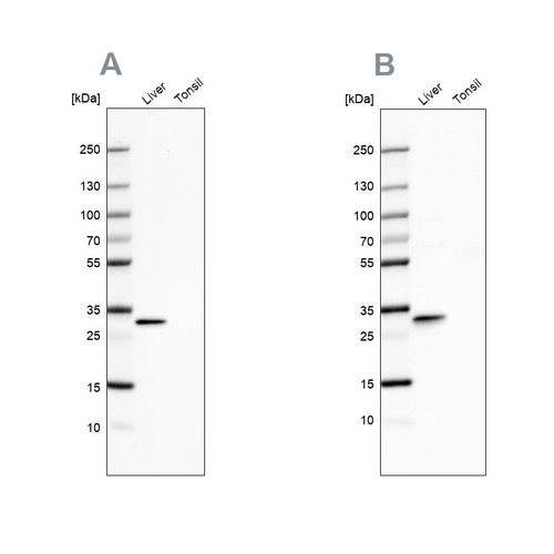Western blot analysis using Anti-PBLD antibody HPA038035 (A) shows similar pattern to independent antibody HPA038036 (B).