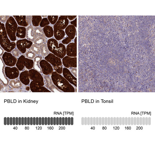 Immunohistochemistry analysis in human kidney and tonsil tissues using Anti-PBLD antibody. Corresponding PBLD RNA-seq data are presented for the same tissues.