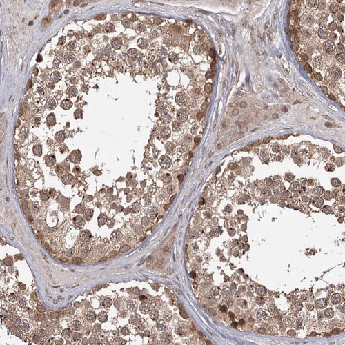 Immunohistochemical staining of human testis shows moderate cytoplasmic positivity in cells in seminiferous ducts.
