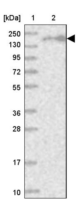 Lane 1: Marker [kDa] 250, 130, 95, 72, 55, 36, 28, 17, 10<br/>Lane 2: Human cell line RT-4