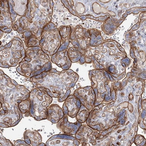 Immunohistochemical staining of human placenta shows moderate membranous positivity in trophoblastic cells.