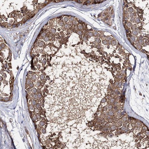 Immunohistochemical staining of human testis shows strong granular cytoplasmic positivity in cells in seminiferous ducts.