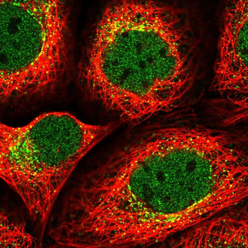 Immunofluorescent staining of human cell line A-431 shows localization to nucleoplasm & vesicles.