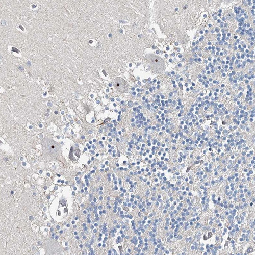 Immunohistochemical staining of human cerebellum shows distinct nucleolar positivity in purkinje cells.