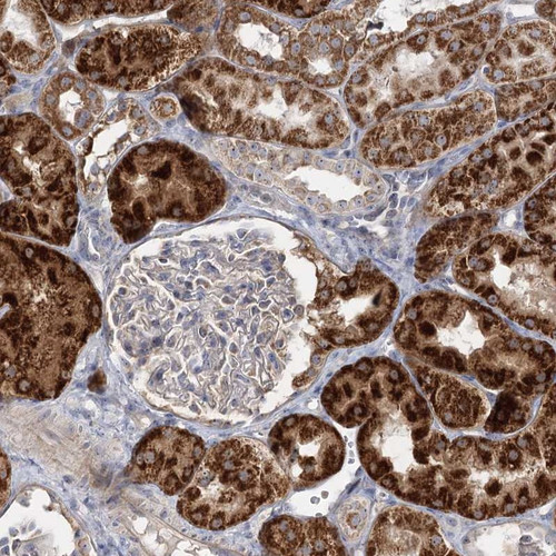 Immunohistochemical staining of human kidney shows strong cytoplasmic positivity in cells in tubules.