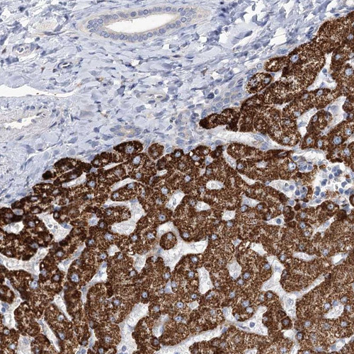Immunohistochemical staining of human liver shows strong cytoplasmic positivity in hepatocytes.