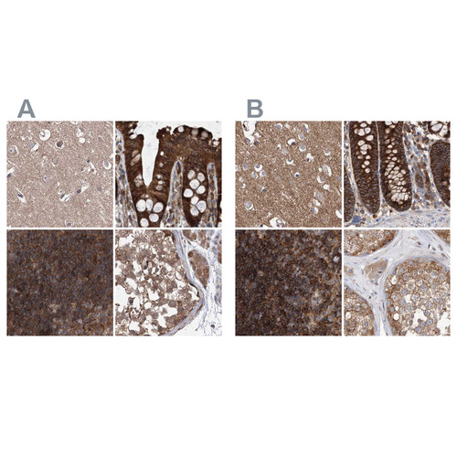 Immunohistochemical staining of human cerebral cortex, colon, lymph node and testis using Anti-VPS37B antibody HPA038217 (A) shows similar protein distribution across tissues to independent antibody HPA038218 (B).