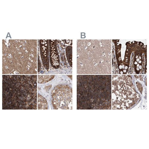 Immunohistochemical staining of human cerebral cortex, colon, lymph node and testis using Anti-VPS37B antibody HPA038218 (A) shows similar protein distribution across tissues to independent antibody HPA038217 (B).