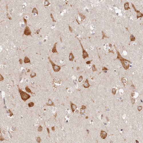 Immunohistochemical staining of human cerebral cortex shows strong cytoplasmic positivity in neurons.