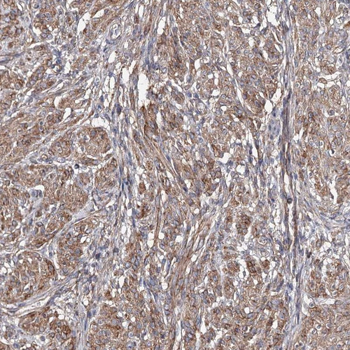 Immunohistochemical staining of human smooth muscle shows moderate cytoplasmic positivity in smooth muscle cells.