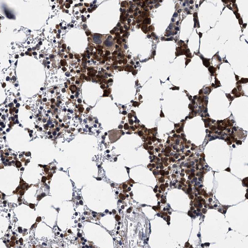 Immunohistochemical staining of human bone marrow shows strong nuclear positivity in hematopoietic cells.
