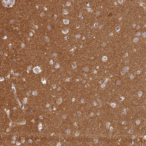Immunohistochemical staining of human cerebral cortex shows strong positivity in neuropil.