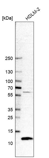 Western blot analysis in human cell line HDLM-2.