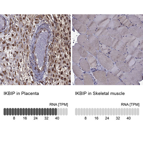 Immunohistochemistry analysis in human placenta and skeletal muscle tissues using Anti-IKBIP antibody. Corresponding IKBIP RNA-seq data are presented for the same tissues.