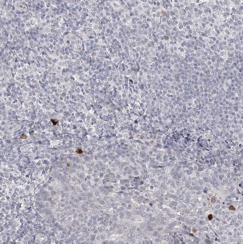 Immunohistochemical staining of human tonsil shows strong cytoplasmic positivity in a small subset of lymphoid cells.