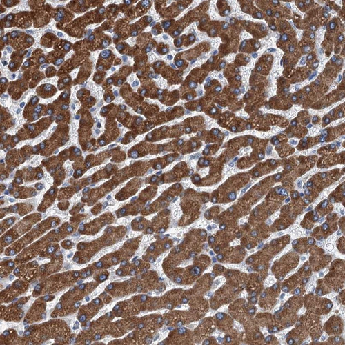Immunohistochemical staining of human liver shows strong granular cytoplasmic positivity in hepatocytes.