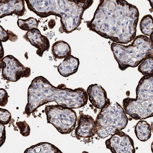 Immunohistochemical staining of human placenta shows strong cytoplasmic positivity in trophoblastic cells.