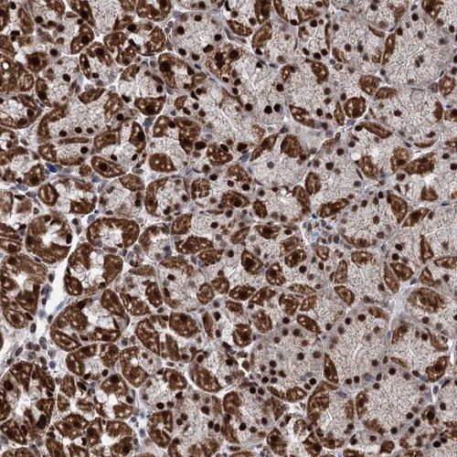 Immunohistochemical staining of human stomach, lower shows strong nuclear and granular cytoplasmic positivity in glandular cells.