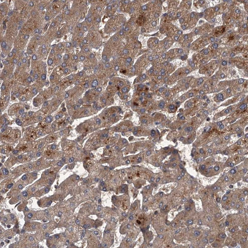 Immunohistochemical staining of human liver shows strong cytoplasmic positivity in hepatocytes.