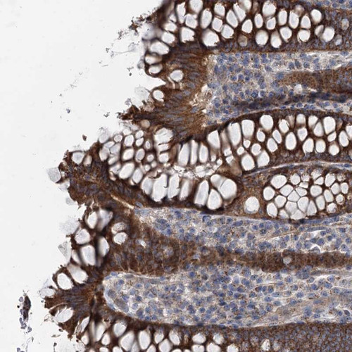 Immunohistochemical staining of human colon shows strong cytoplasmic positivity in glandular cells.