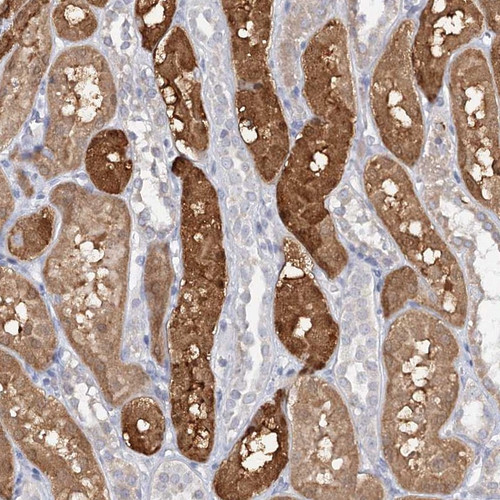 Immunohistochemical staining of human kidney shows moderate cytoplasmic positivity in cells in tubules.