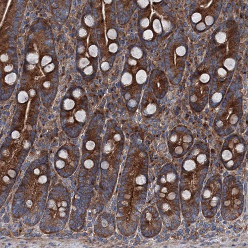 Immunohistochemical staining of human duodenum shows strong cytoplasmic positivity in glandular cells.