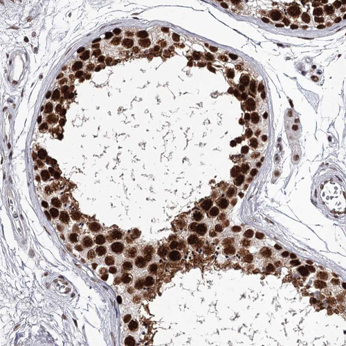 Immunohistochemical staining of human testis shows nuclear positivity in cells in seminiferous ducts.
