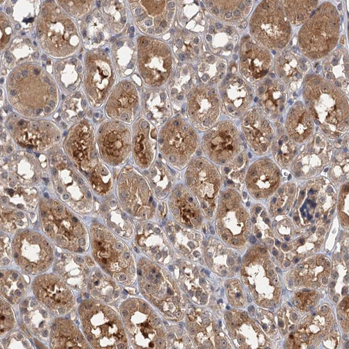 Immunohistochemical staining of human kidney shows moderate cytoplasmic and nucleolar positivity in tubular cells.