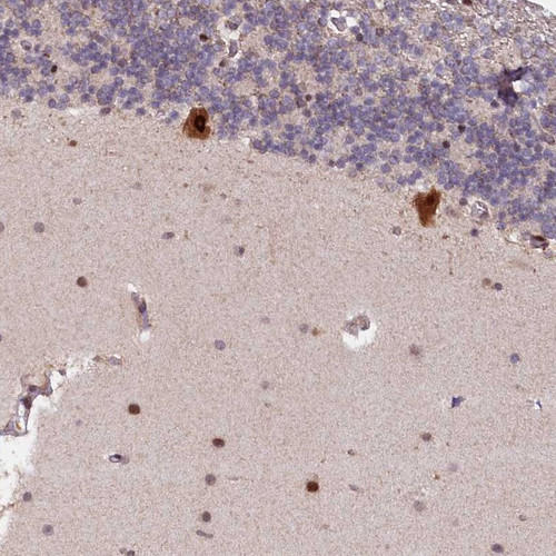 Immunohistochemical staining of human cerebellum shows strong cytoplasmic and nuclear positivity in Purkinje cells.