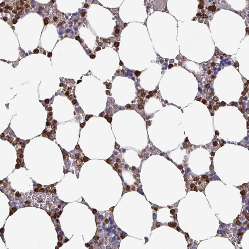 Immunohistochemical staining of human bone marrow shows strong cytoplasmic positivity in hematopoietic cells.