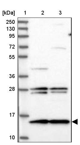 Lane 1: Marker [kDa] 250, 130, 95, 72, 55, 36, 28, 17, 10<br/>Lane 2: Human cell line RT-4<br/>Lane 3: Human cell line U-251MG sp